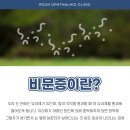 로운안과의원 이미지