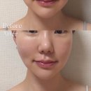 쥬 | 셀비전 쎄라쥬 4주 사용후기｜올인원 홈케어 디바이스 추천 이유