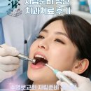 치과치료 후기 // 첫 번째 청년 치료 후기