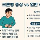 단순 장염이 아닐 수도? 크론병 전조증상 3가지 이미지