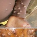토실 프로젝트
