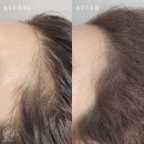 김헤어라인 이미지