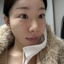 상봉비브톤의원 네이버블로그