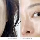뷰티 썸 스킨 이미지