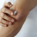 샤인원의원 이미지