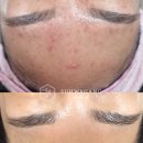 피부를 말하다 이미지