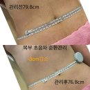 5408 | 대전 지족동 피부관리샵 '올가드림뷰티 유성 1호점' 2번째 방문 복부 집중관리 후기