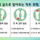 "허리건강, 신발 굽 닳는 부위로 측정할 수 있어요" 이미지