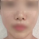 구리윤곽관리 <아르네 스파> 구리 호텔급 스파 후기
