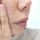 신 복만네종합식품 | 라이신 영양제 입술포진 관리에 도움된 제트리션 후기