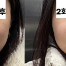 닥터구의원 티슬림 내돈내산 후기 - 짜릿해..최고야..