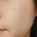 웰레스테틱 수원점 이미지