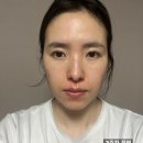 린동물병원 | 홈케어 고주파기기 린커브 한달후기