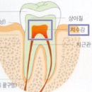 상아플란트치과 네이버블로그