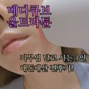 [메디큐브 울트라튠] 내돈내산.개복치 피부염쟁이 후기.공홈 구매 추천!