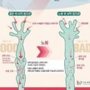 몸속에 독소 뇌 속 노폐물 배출 뇌척수액 역할 이미지