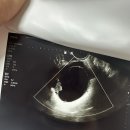 지오스마일상사(주) | 첫 임신 그리고 첫 유산 : 임신준비 영양제부터 스마일리더 사용, 한방에 임신성공하고 바로 조리원...