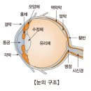 백내장(Cataract) 및 녹내장(Glaucoma) 이미지