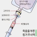 링거 이미지