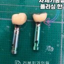 FIT치과기공소 이미지
