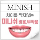 미니쉬치과기공소 | 미니쉬 비용부터 부작용까지 한눈에 정리!