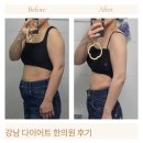 자영한의원 | 강남 다이어트 한의원 40대 나잇살까지 관리한 밀감정 리얼 후기