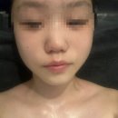 [제이스킨앤바디]춘천피부관리 춘천에스테틱 첫체험후기 최고실력 원장님 원장님손길최고