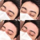 홍 헤어라인 이미지