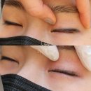 동읍107 | 창원 동읍 아이라인 제거 고객후기로 만나보세요