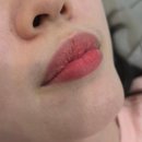 송  천 | wd- 웨딩촬영준비 청주 왁싱 제모 뷰티샵 &#39;송앤뷰티&#39; 인중왁싱 후기