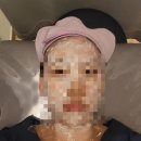 (주)리샘 | 천안아산 편평사마귀 잘하는 곳! 얼굴목 무제한 제거 가능 성지가 될 곳 내돈내산 추천 후기