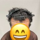 모우다의원 | 서울 강남구 신사동 탈모관리 모우다의원 위치 가격 후기