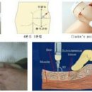 주사를 맞는 데 도움 되는 정보 이미지