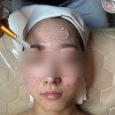화서(영덕) | [수원] 화서역 문제성피부 모공 줄이기 뷰티스페셜 후기