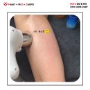 패션세탁소 | 여름패션! 자신감 되찾은 포항팔뚝관리 3차 리얼후기