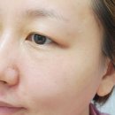 색소침착 셀비엔기미딱지패치 세트로 케어해요