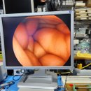독일제 Rigid Endoscope (Clear View) ...... 이미지