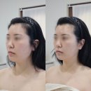 GS25 경산옥산점 | 경산피부관리 윤곽관리 맞춤관리 후기) 물오른 피부 경산점