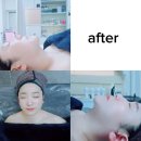 짱앤짠 | 광주 문제성 피부관리 하남동 퓨어스킨앤왁싱 피부고민 해결 코스