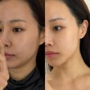 상왕십리역 | 왕십리 에스테틱 상왕십리역 클링에스테틱 얼굴 전체 리프팅 리얼후기