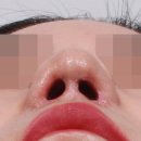 최우식노즈립성형외과의원 이미지