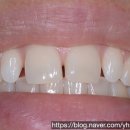 연희세브란스치과의원 이미지