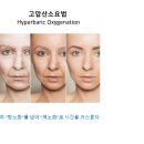 [&#34;고압산소치료요법 Hyperbaric Oxygenation&#34;] 암치료, 노화방지, 피부재생 / 리업필라테스 이미지