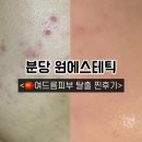 원에스테틱 | [경기/성남] 분당 야탑 피부관리 원에스테틱 여드름, 모낭염 완벽케어 솔직한 후기!