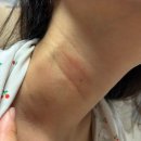 현진환경개발 | 만난 디오셀 토너와 레이엔 로션으로 건선, 모공각화증, 여드름 없앤 리얼 후기 가격 정보