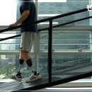 경기 의수족 보조기 이미지