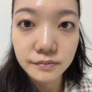 톡톡 메디칼 | 엑소나노리바이브크림 8일보습 후기｜톡톡 두드리니 흡수 빠른 보습크림