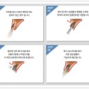 시애틀치과의원 네이버블로그