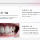 청구치과기공소 이미지