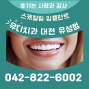 유성빌딩 | [대전 치과 후기] 유디치과 대전유성점, 스케일링과 임플란트 추천해요